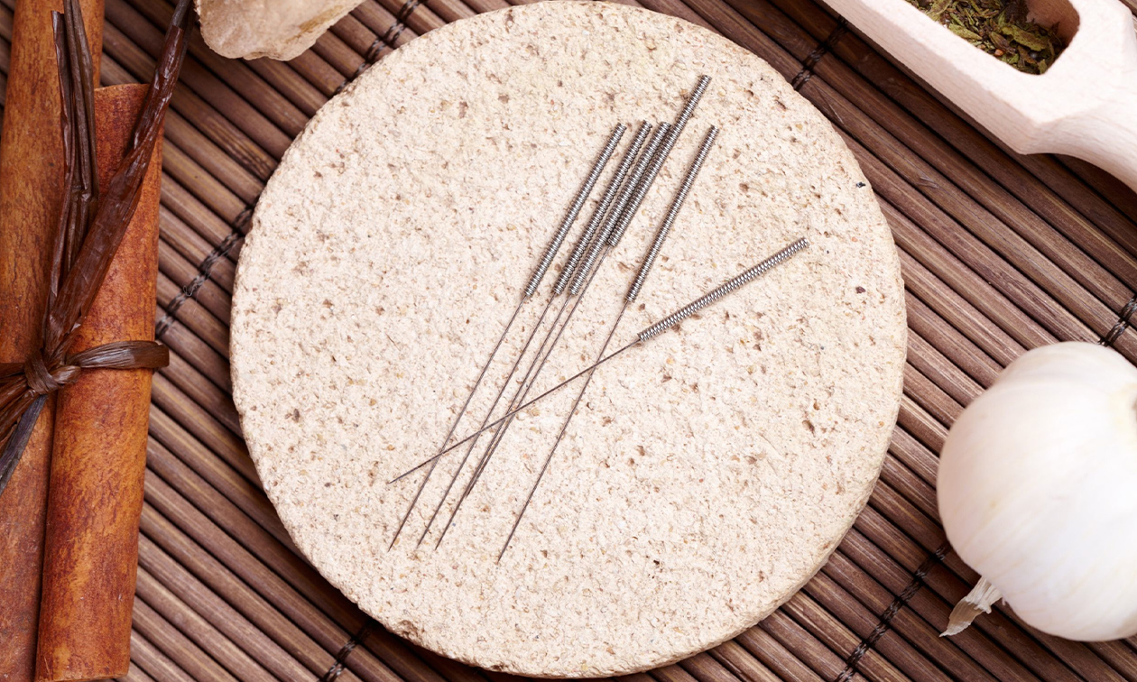 Acupunctuur Breda