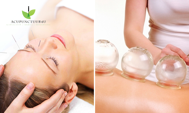 Acupunctuur (60 min) of moxa-therapie (45 min)