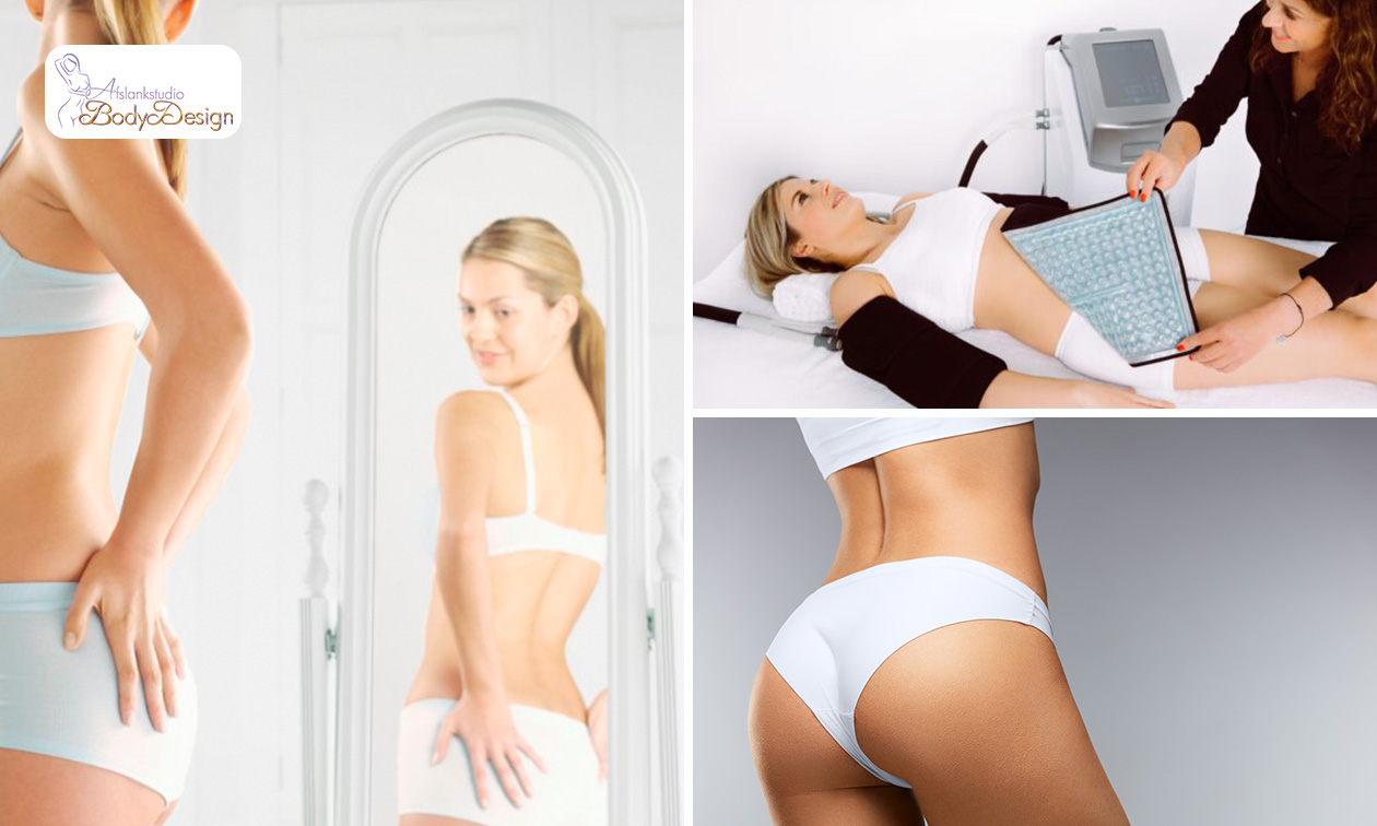 Afslankbehandeling naar keuze