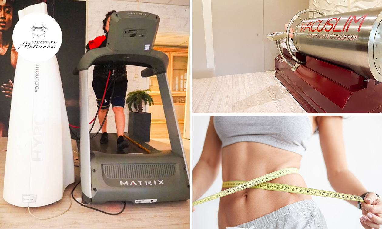 Cryolipolyse-afslankbehandeling