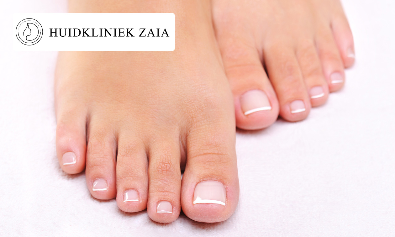 1 of 3 kalknagelbehandelingen voor 10 nagels