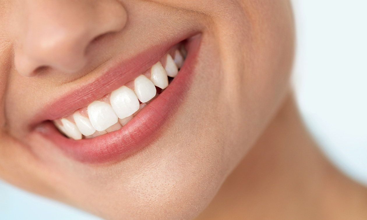 3, 4 of 5 sessies tandenbleken