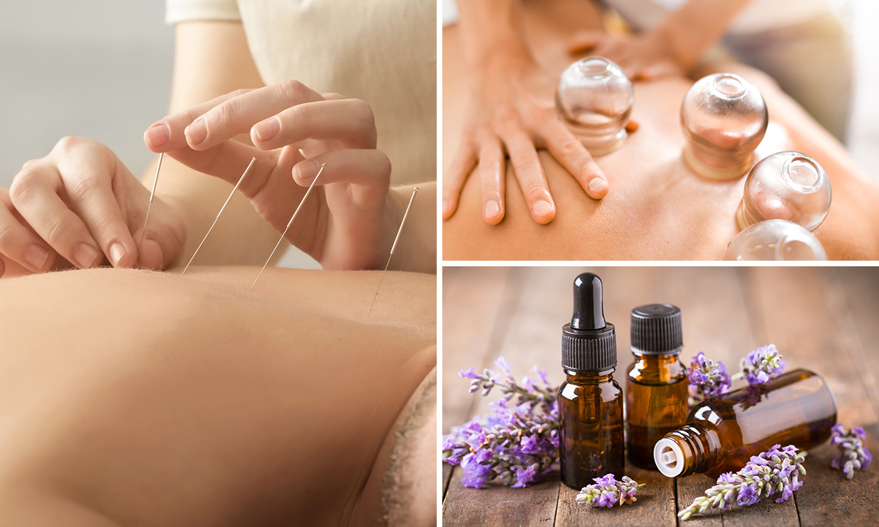 Cupping, acupunctuur en/of kruidenbehandeling + intake