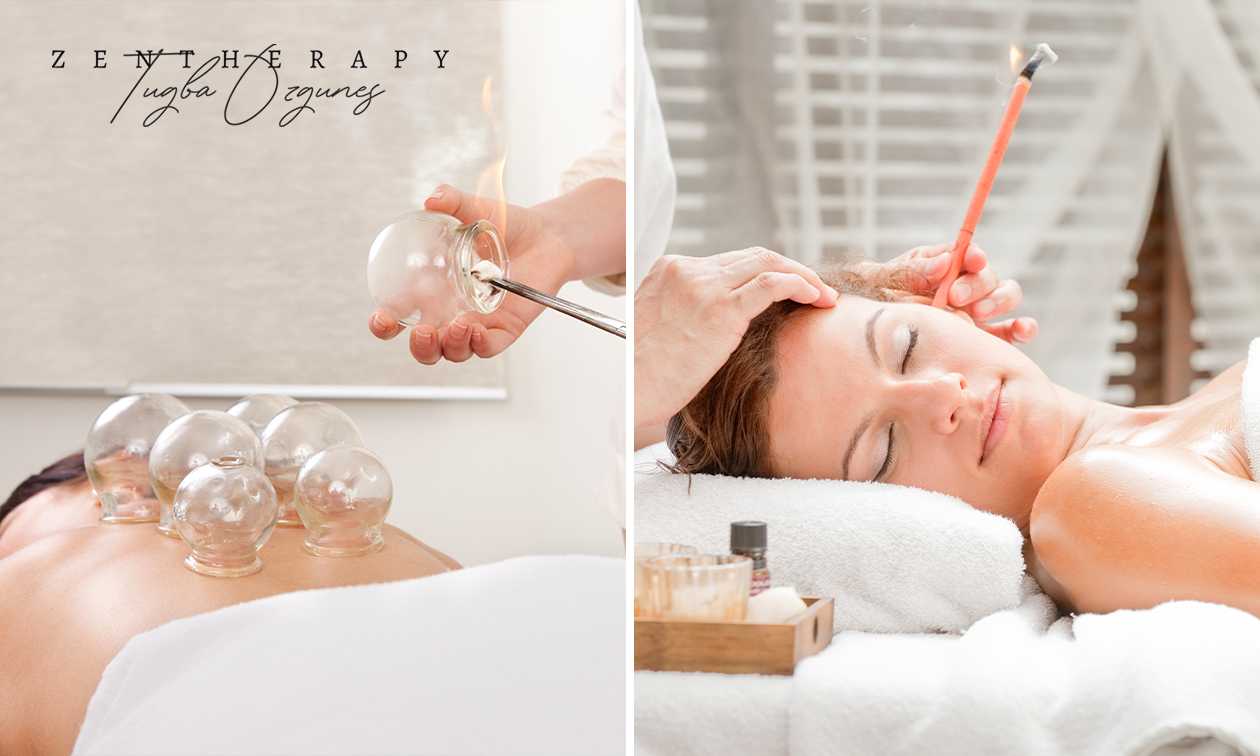Cuppingsbehandeling of massage naar keuze